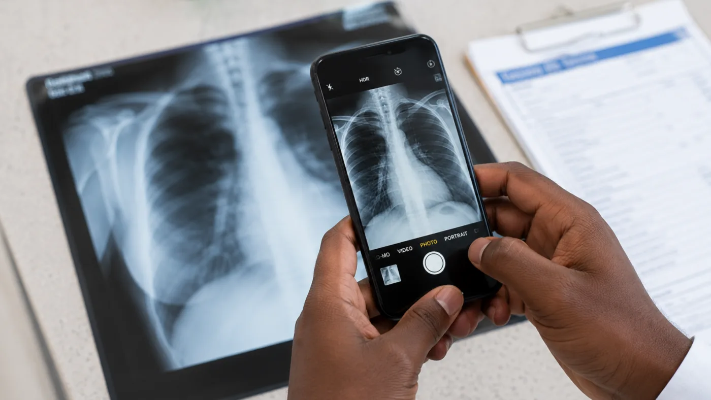Hands holding a phone that is photographing a chest X-ray